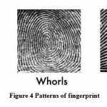 Figure 4 Patterns of fingerprint