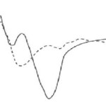Fig 2. P3 evoked potential