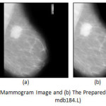 Figure 2:	(a) The Original Mammogram Image and (b) The Prepared Mammogram Image (MIAS mdb184.L)