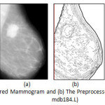Figure 3:	(a) The prepared Mammogram and (b) The Preprocessed Mammogram (MIAS mdb184.L)