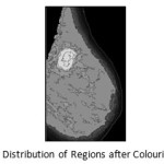 Figure 4:	Intensity Distribution of Regions after Colouring (MIAS mdb184.L)
