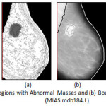 Figure 5:	(a) Highlighted Regions with Abnormal Masses and (b) Boundary of Abnormal Regions (MIAS mdb184.L)