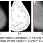 Figure 6:	MIAS mdb272.L: (a) Prepared Mammogram, (b) Coloured Anatomical Regions and (c) Derived Image showing Absence of Boundary of Abnormal Region(s)