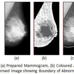 Figure 7:	MIAS mdb028.L: (a) Prepared Mammogram, (b) Coloured Anatomical Regions and (c) Derived Image showing Boundary of Abnormal Region(s)