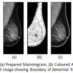 Figure.8 DEMS 79 LMLO: (a) Prepared Mammogram, (b) Coloured Anatomical Regions and (c) Derived Image showing Boundary of Abnormal Region(s)