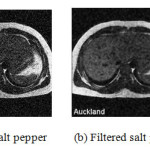Fig10. (a) Salt pepper (b) Filtered salt pepper image