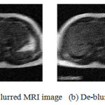 Fig4. (a)Blurred MRI image (b) De-blurred Image