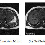 Fig6. (a)Gaussian Noise (b) De-Noised Image