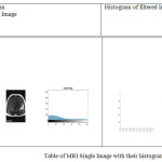 Table of MRI Single Image with their histogram