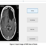 Figure 1 Input Image of MRI Scan of brain