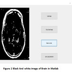 Figure 2 Black And white image of Brain in Matlab