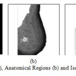 Figure10: Mammogram (a), Anatomical Regions (b) and Isolated Abnormal Masses (c)