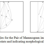 Figure13: Computed Triangles for the Pair of Mammogram image showing the respective Landmark points and indicating morphological Asymmetry