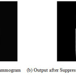 Figure 5: (a) Original Mammogram     (b) Output after Suppression of Pectoral Muscle
