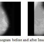 Figure 6: Mammogram before and after Image Registration