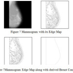 Figure7: Mammogram Edge Map along with derived Breast Contour