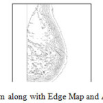 Figure 8: Mammogram along with Edge Map and Anatomical Regions
